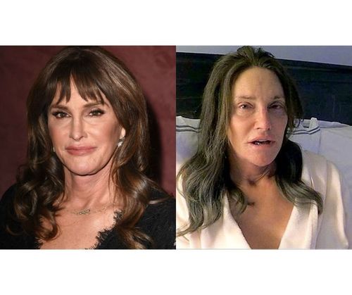 35_Celebrities_Without_Makeup
