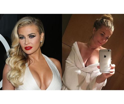 56_Celebrities_Without_Makeup