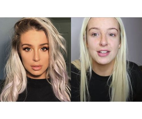 59_Celebrities_Without_Makeup