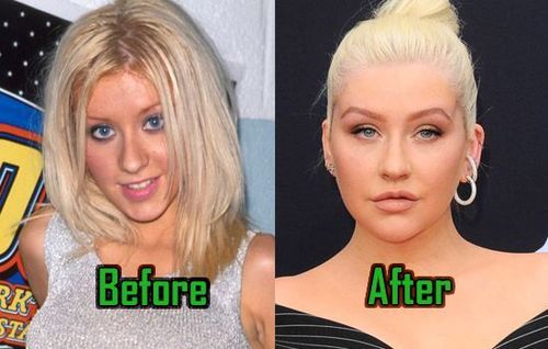 Christina Aguilera Plastic Surgery Secrets - Know Everything | Fabbon