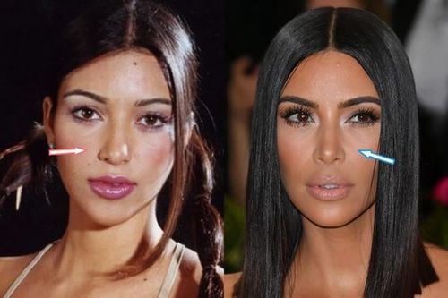 Celebrity Nose Job Before And After Women