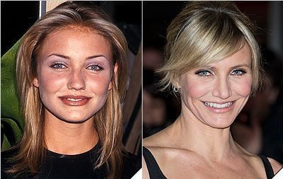 51 Most Popular Celebrity Nose Jobs: Before And After With Images | Fabbon
